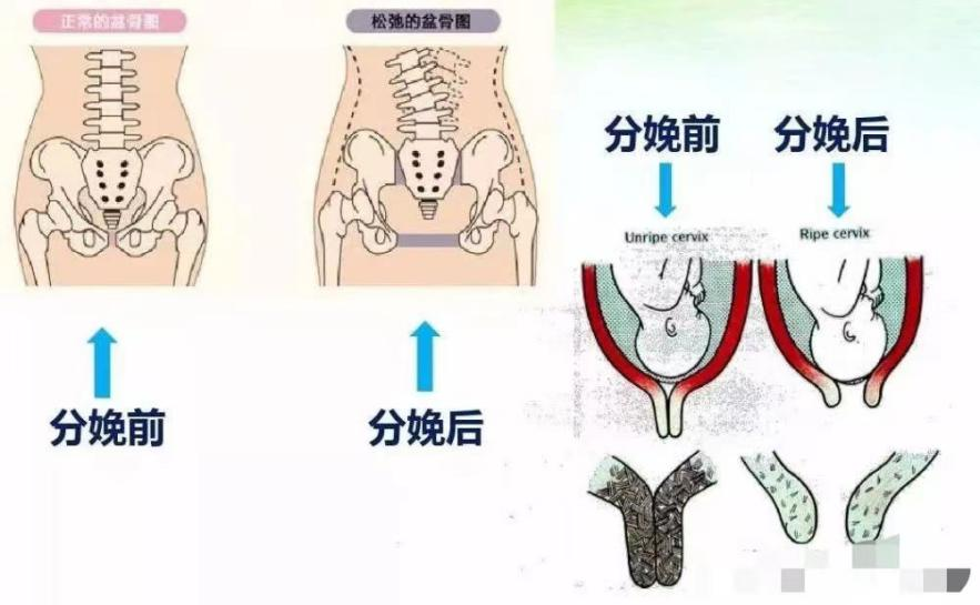 02盆底组织损伤原因怀孕和分娩.png